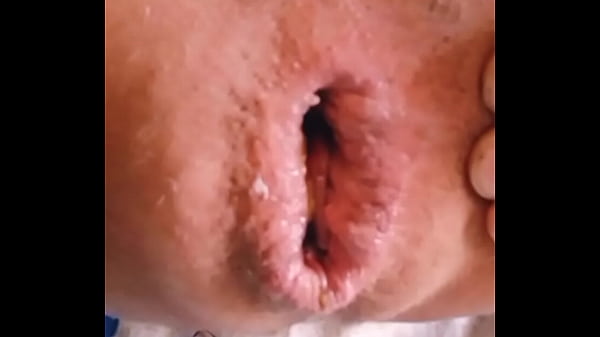 Se me dilató la conchita