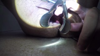 Wanna see my insides?